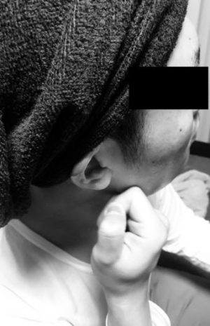顔の歪みを治す矯正法