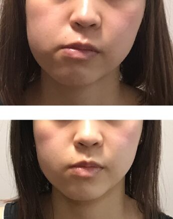 顔の左右非対称を治したい 顔ドック
