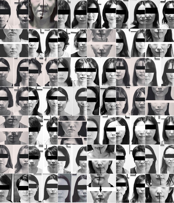 小顔矯正の効果を維持する方法 顔専門矯正サロン 顔ドック