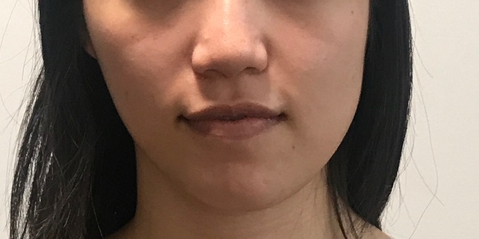 左右非対称 顔の歪みを治して小顔になりたい方の矯正サロン 林幸千代の顔ドック