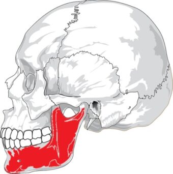 歯列と顔の歪みの関係
