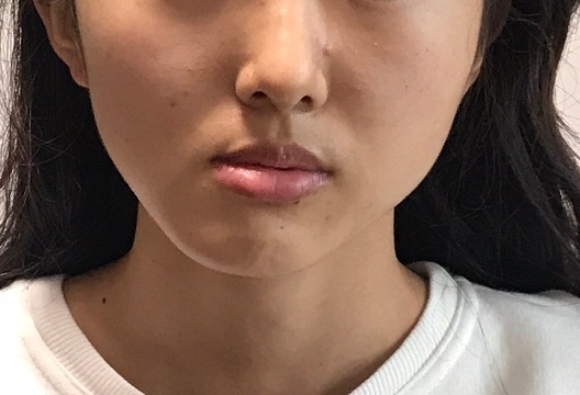 顔のエクササイズは効果がありますか?