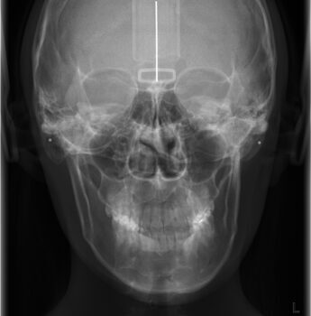 医学的根拠に基づいた小顔矯正