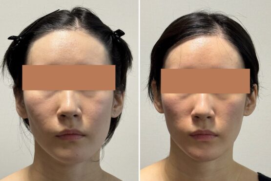 林幸千代が指導するセルフマッサージの重要性