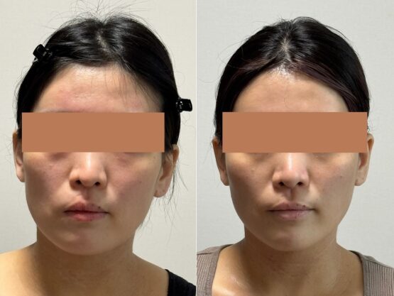 顔の左右差や顎（アゴ）の歪みが気になる。