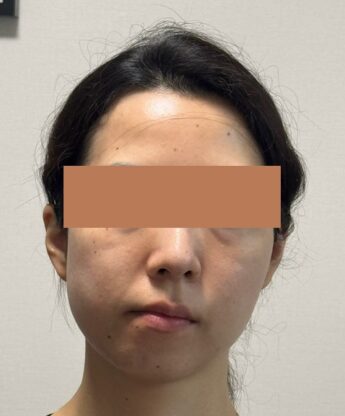 外科手術をしないで顔の歪みを改善する『顔ドック』