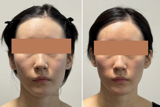 顔の歪みが治った2026