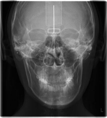 顔の歪み研究機関の顔ドック