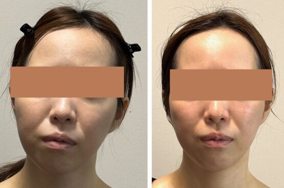 自然な若返り『顔ドック』