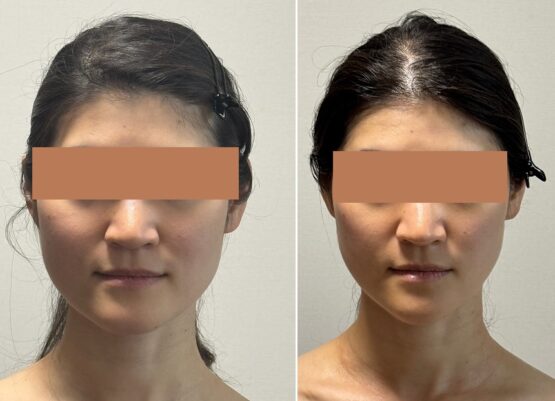 エラが張って、顔が大きく見える